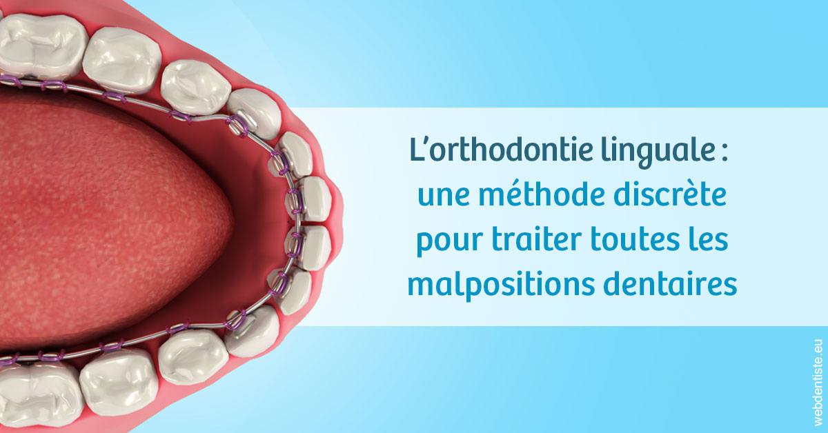 https://www.orthodontiste-nogentsurmarne.com/L'orthodontie linguale 1