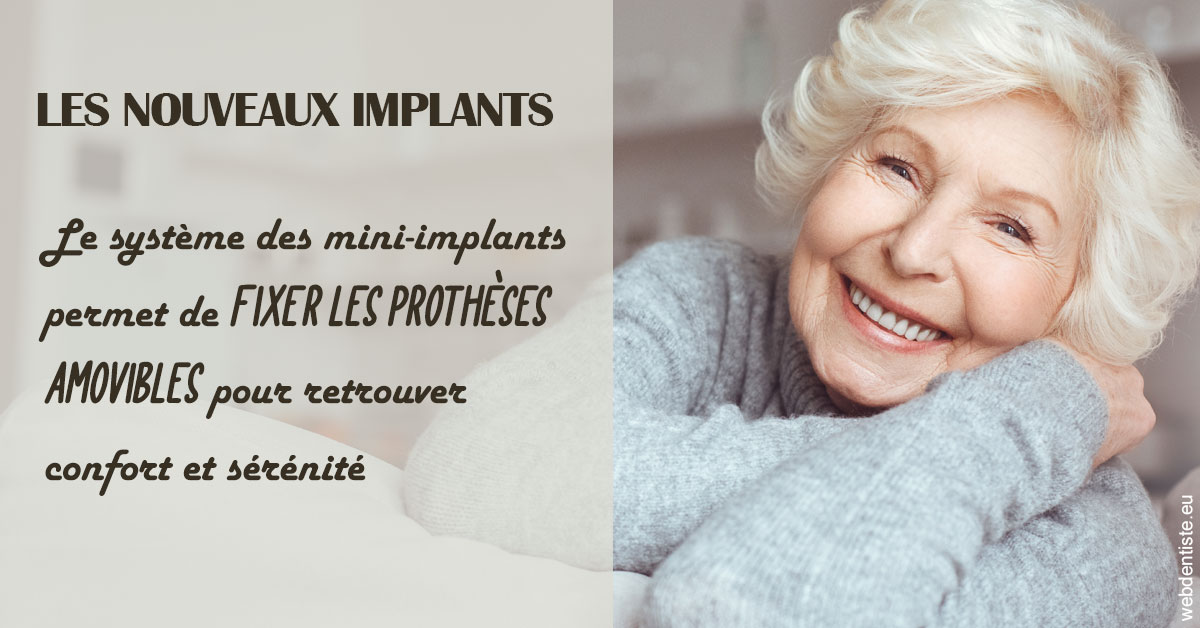 https://www.orthodontiste-nogentsurmarne.com/Les nouveaux implants 1