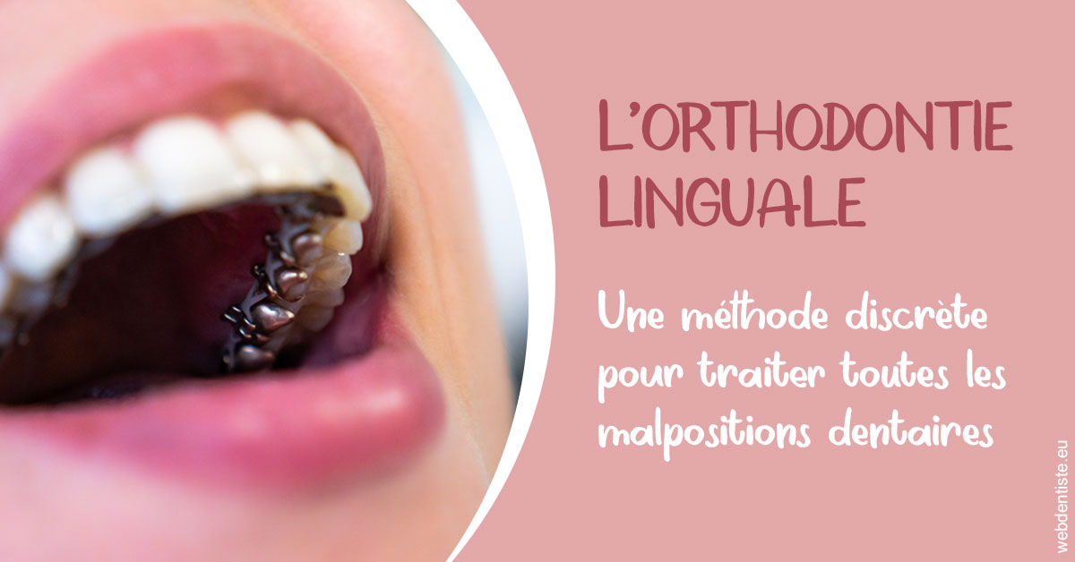 https://www.orthodontiste-nogentsurmarne.com/L'orthodontie linguale 2