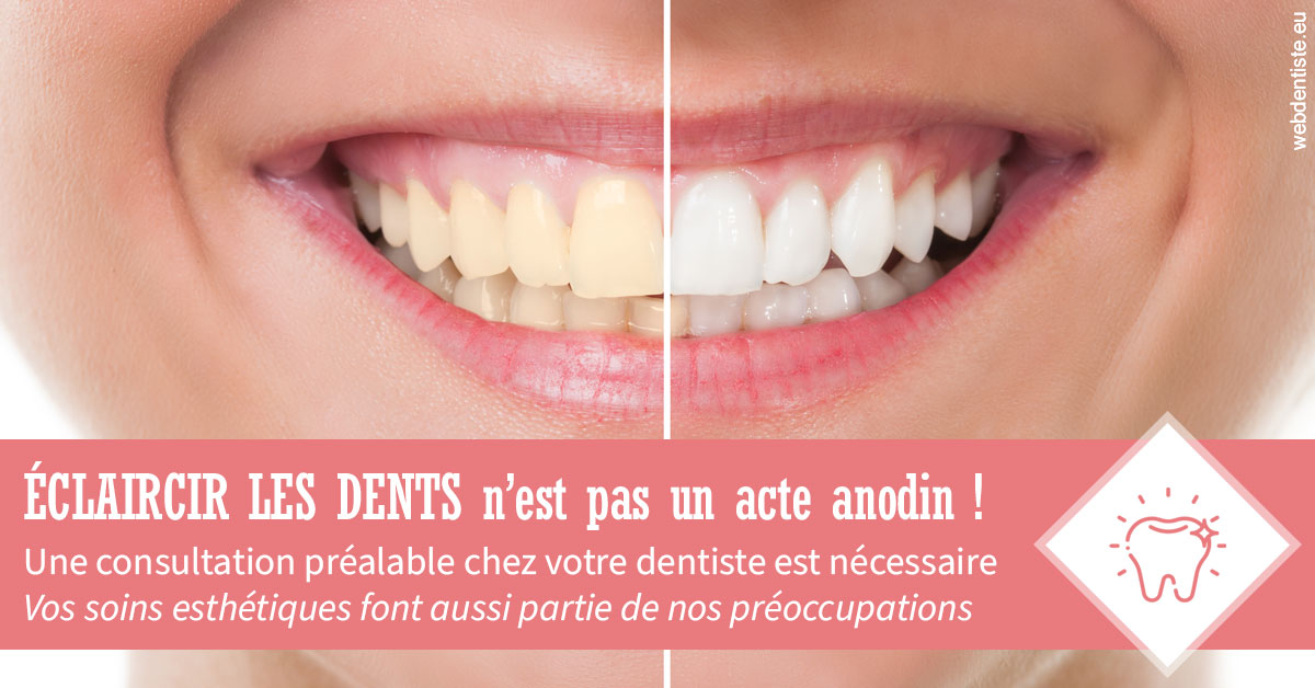 https://www.orthodontiste-nogentsurmarne.com/Eclaircir les dents 1