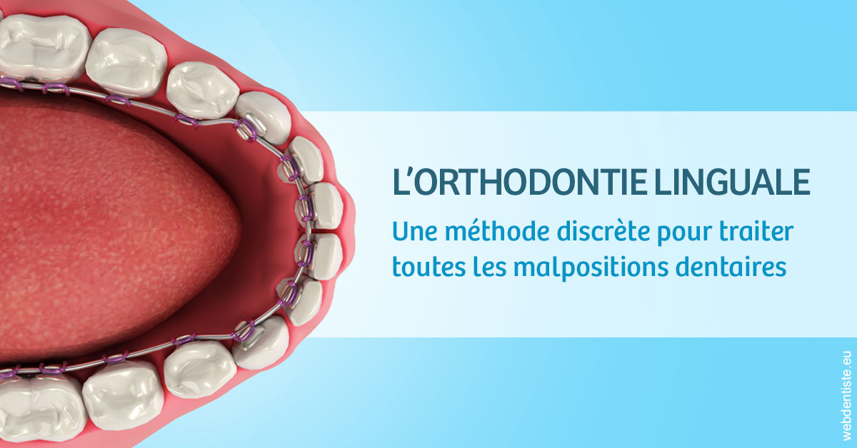 https://www.orthodontiste-nogentsurmarne.com/L'orthodontie linguale 1