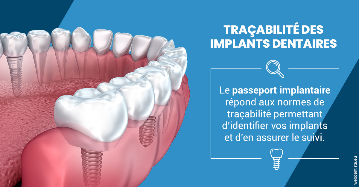 https://www.orthodontiste-nogentsurmarne.com/T2 2023 - Traçabilité des implants 1