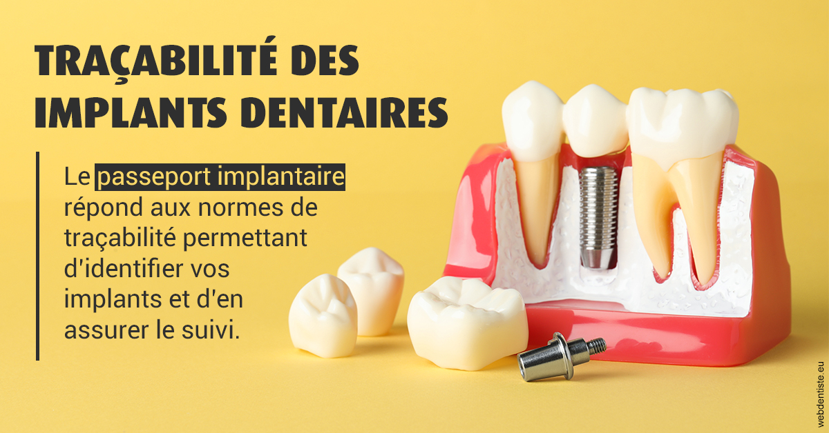 https://www.orthodontiste-nogentsurmarne.com/T2 2023 - Traçabilité des implants 2