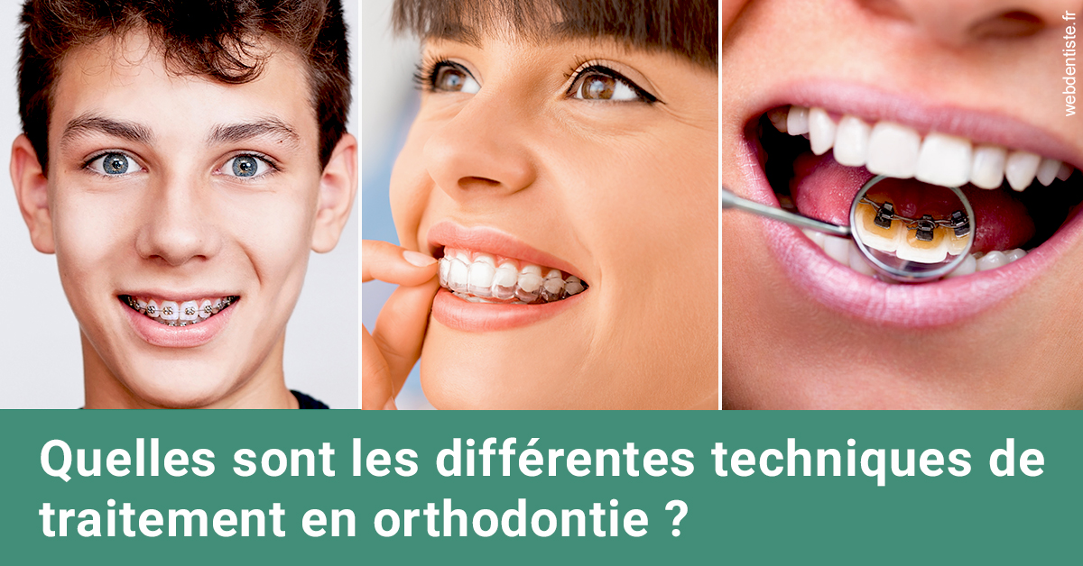 https://www.orthodontiste-nogentsurmarne.com/Les différentes techniques de traitement 2