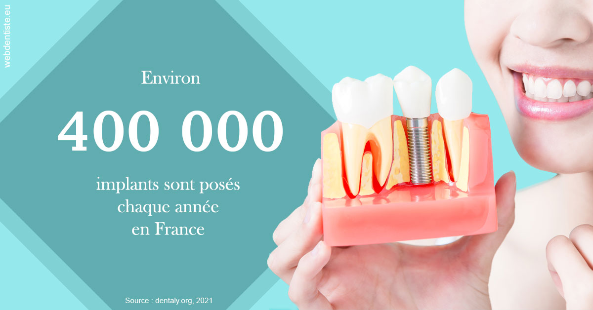 https://www.orthodontiste-nogentsurmarne.com/Pose d'implants en France 2