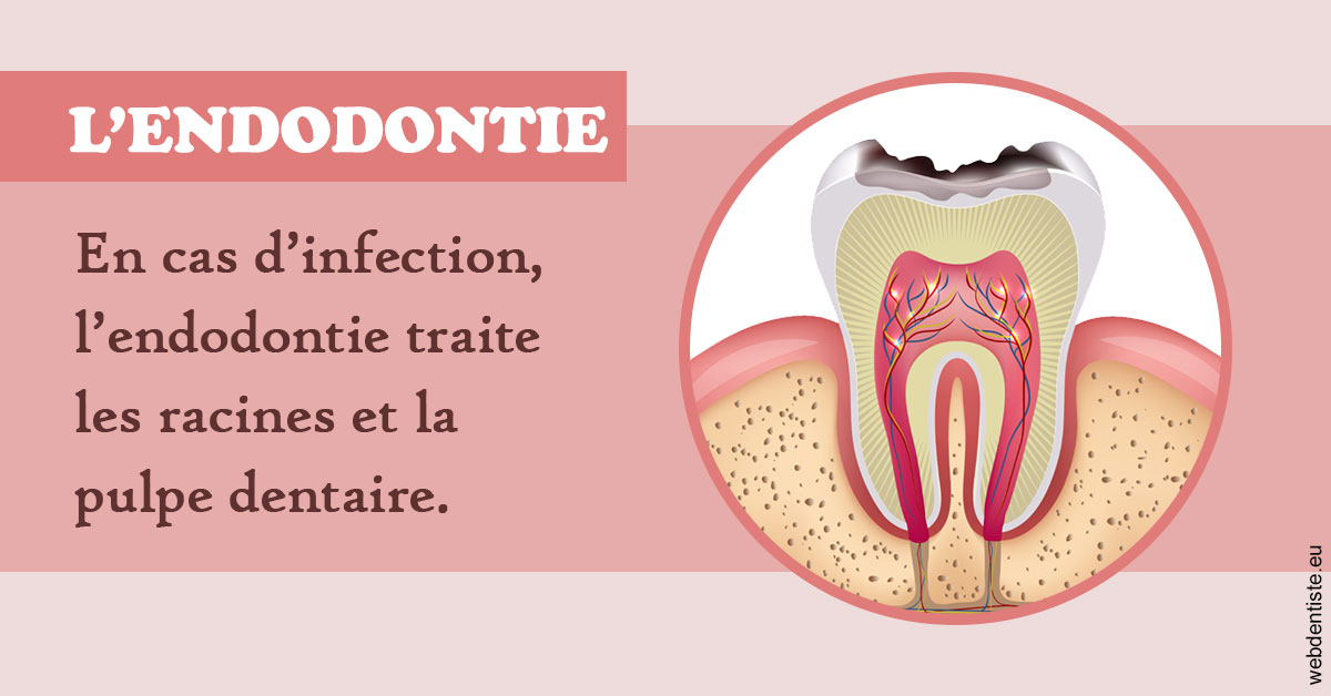 https://www.orthodontiste-nogentsurmarne.com/L'endodontie 2
